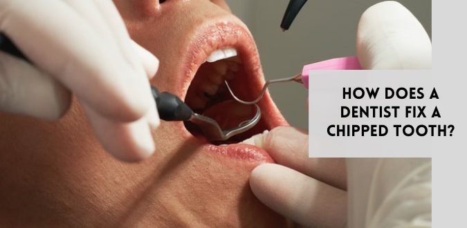 Dentist Fix a Chipped Tooth