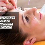 Different Types of Acupuncture Treatment