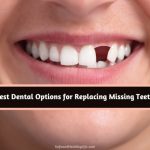 Dental Options for Replacing Missing Teeth