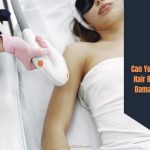 Can You Get Laser Hair Removal On Damaged Skin?
