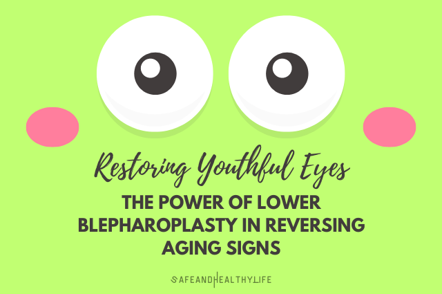 Blepharoplasty in Reversing Aging Signs