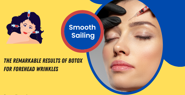 Botox for Forehead Wrinkles