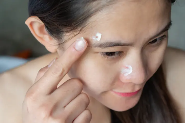 Acne scar creams