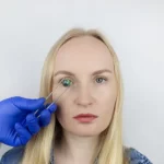 Do You Have Cataracts? Here's Possible Treatment Options