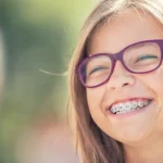 Important Things to Keep in Mind if Your Child Gets Braces Important Things to Keep in Mind if Your Child Gets Braces