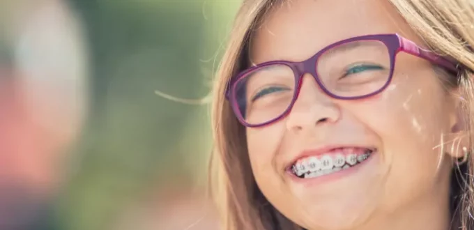 Important Things to Keep in Mind if Your Child Gets Braces