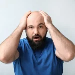 How Hair Transplant Treatment Options Can Restore Your Hairline How Hair Transplant Treatment Options Can Restore Your Hairline