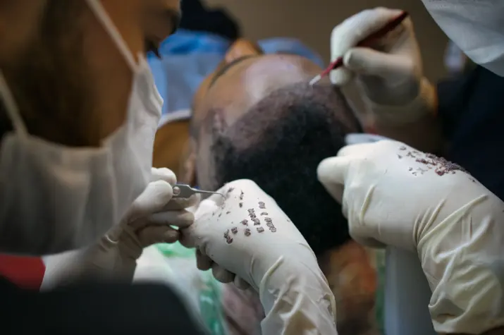 Preparation and Procedure