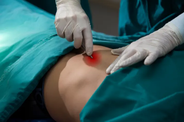 Healthy Tissues Preserved