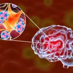 Meningitis: Everything You Need To Know Meningitis: Everything You Need To Know