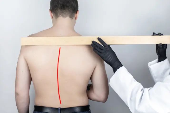 Correction of Spinal Deformities