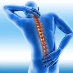 5 Ways Spine Fusion Surgery Helps Relieve Pain and Instability 5 Ways Spine Fusion Surgery Helps Relieve Pain and Instability