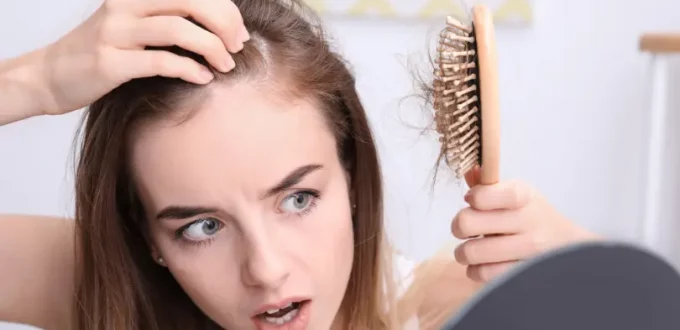 Do You Have Alopecia?