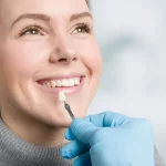 Expert Insights on Single-Tooth Veneers Expert Insights on Single-Tooth Veneers