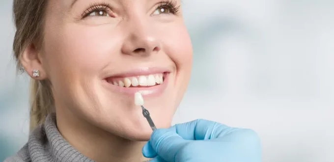 Expert Insights on Single-Tooth Veneers