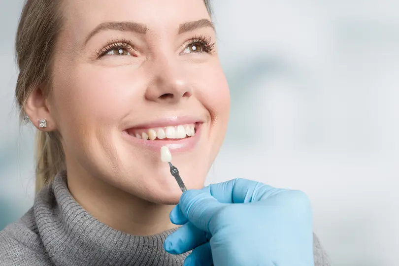 Expert Insights on Single-Tooth Veneers
