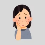 What Causes Acne & How Can You Get Rid of It?