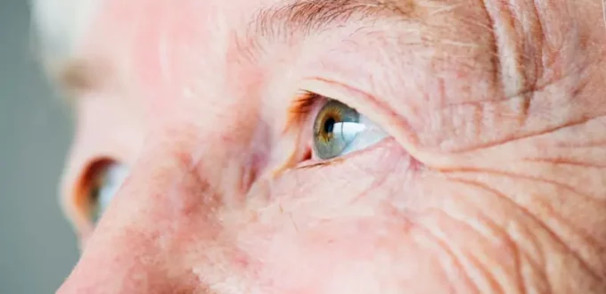 3 Warning Signs of Cataracts