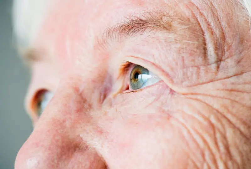 3 Warning Signs of Cataracts