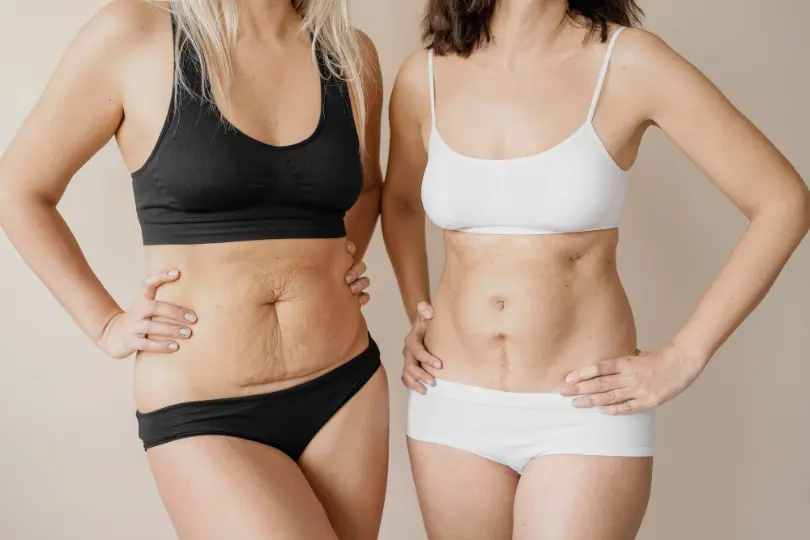 Overcoming the Impact of Significant Weight Loss