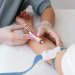 Complex Care: How Specialized Pharmacies Can Help Expert Knowledge and Support for Complex Therapies