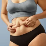 When You Should Consider Getting A Tummy Tuck