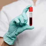 What is Hemostasis in the Context of Surgery What is Hemostasis in the Context of Surgery