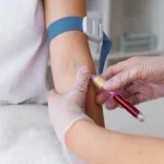 How to Prepare for a C-Reactive Protein (CRP) Blood Test: A Step-by-Step Patient Guide How to Prepare for a C-Reactive Protein (CRP) Blood Test: A Step-by-Step Patient Guide