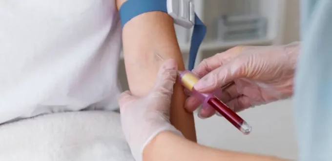 How to Prepare for a C-Reactive Protein (CRP) Blood Test: A Step-by-Step Patient Guide