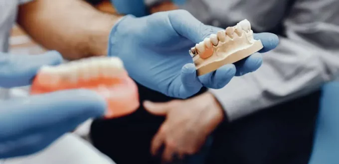 5 Factors That Affect the Cost of Dental Implants