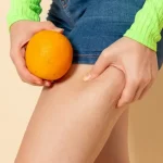 Exercise and Nutrition Tips for Vein Health