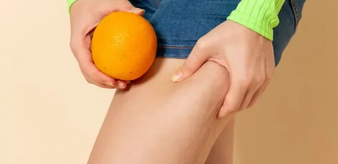 Exercise and Nutrition Tips for Vein Health